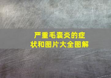 严重毛囊炎的症状和图片大全图解