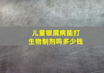 儿童银屑病能打生物制剂吗多少钱