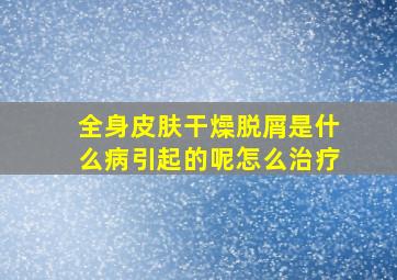 全身皮肤干燥脱屑是什么病引起的呢怎么治疗