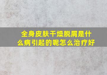 全身皮肤干燥脱屑是什么病引起的呢怎么治疗好