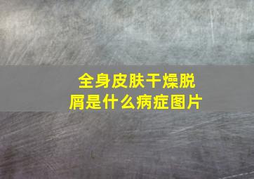 全身皮肤干燥脱屑是什么病症图片