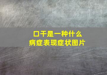 口干是一种什么病症表现症状图片