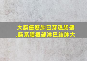 大肠癌癌肿已穿透肠壁,肠系膜根部淋巴结肿大