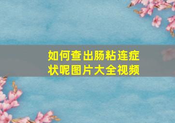 如何查出肠粘连症状呢图片大全视频