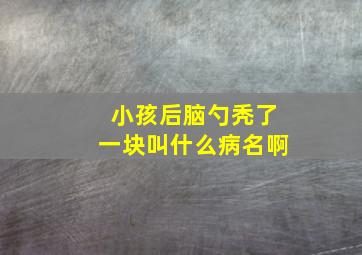 小孩后脑勺秃了一块叫什么病名啊