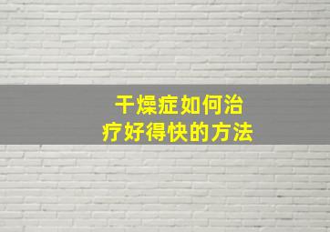 干燥症如何治疗好得快的方法