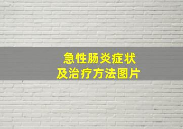 急性肠炎症状及治疗方法图片