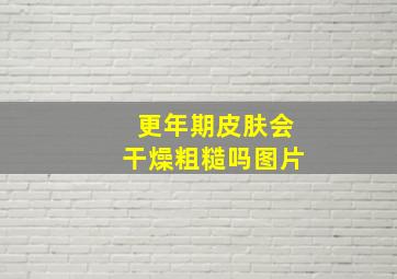 更年期皮肤会干燥粗糙吗图片