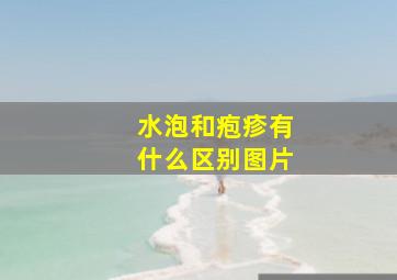 水泡和疱疹有什么区别图片