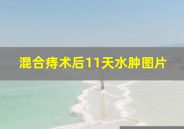 混合痔术后11天水肿图片