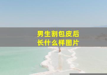 男生割包皮后长什么样图片