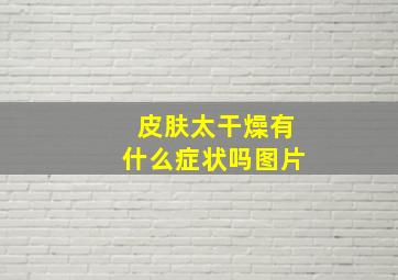 皮肤太干燥有什么症状吗图片