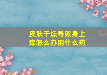 皮肤干燥导致身上痒怎么办用什么药