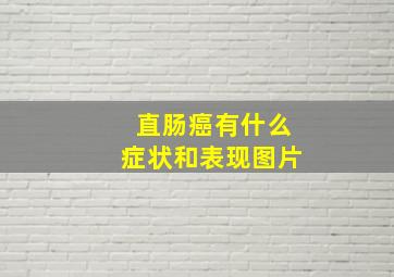 直肠癌有什么症状和表现图片