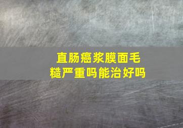 直肠癌浆膜面毛糙严重吗能治好吗