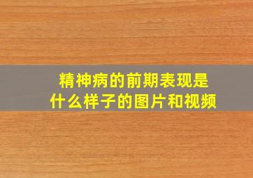 精神病的前期表现是什么样子的图片和视频