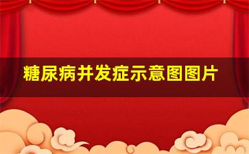 糖尿病并发症示意图图片