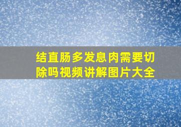 结直肠多发息肉需要切除吗视频讲解图片大全