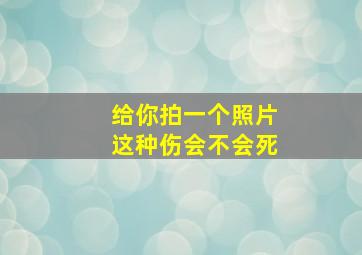 给你拍一个照片这种伤会不会死