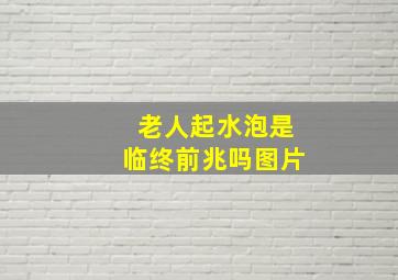 老人起水泡是临终前兆吗图片