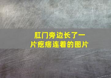 肛门旁边长了一片疙瘩连着的图片