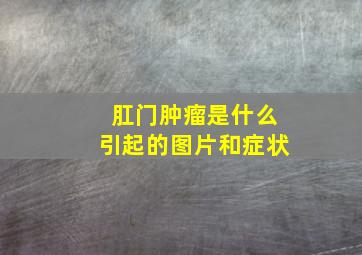 肛门肿瘤是什么引起的图片和症状