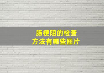 肠梗阻的检查方法有哪些图片