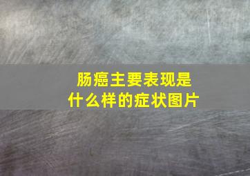 肠癌主要表现是什么样的症状图片