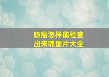 肠癌怎样能检查出来呢图片大全