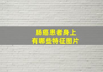 肠癌患者身上有哪些特征图片