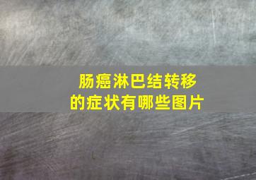 肠癌淋巴结转移的症状有哪些图片