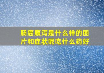 肠癌腹泻是什么样的图片和症状呢吃什么药好