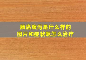 肠癌腹泻是什么样的图片和症状呢怎么治疗