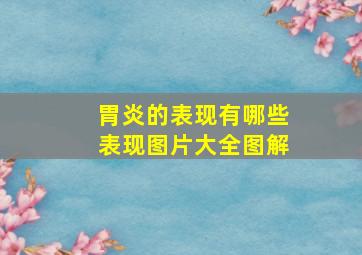 胃炎的表现有哪些表现图片大全图解