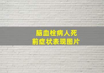 脑血栓病人死前症状表现图片