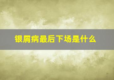 银屑病最后下场是什么