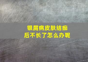 银屑病皮肤结痂后不长了怎么办呢